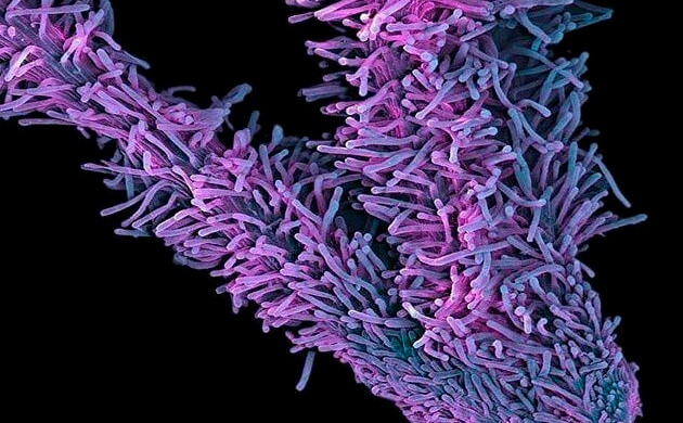 Ворсистые пестики под микроскопом